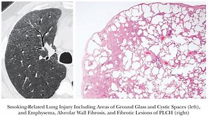 Development and Evaluation of a Logical Delta Check for Identifying Erroneous Blood Count Results in a Tertiary Care Hospital