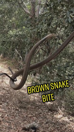 Terrifying Encounter: Eastern Brown Snake Bite Sends Mick to the Hospital