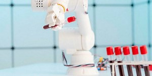 Un nouveau test sanguin pour mieux dépister le cancer de la prostate