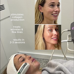 47 reactions · 12 comments |  Say Goodbye to Sagging Skin – No...