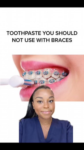 Toothpaste for Braces: What You Should Avoid