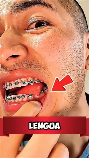 🎭 ¿Paréntesis de más? El error que NADIE nota 👀✍️ #shorts