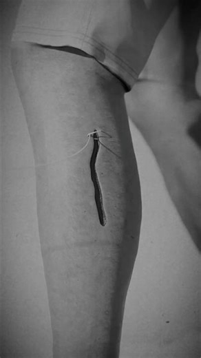 How Stitches Work 😵