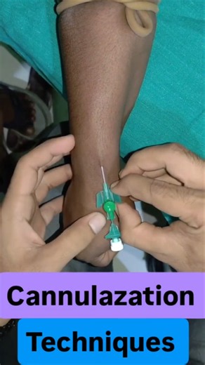 IV Cannulation Techniques | Step-by-Step Peripheral IV Cannula Insertion | Nursing Skills #shorts