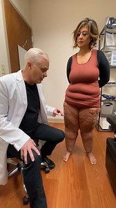 3.6K views · 27 reactions | Dr Wright shows and discusses treatment of leg lobules on a Type 3 Stage 3 Lipedema patient ❤️ | Laser Lipo and Vein Center | Facebook