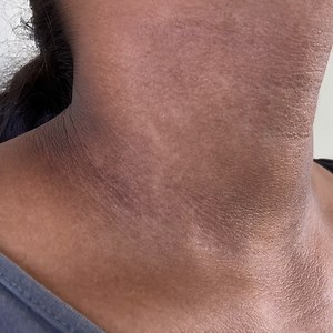 158K views · 2.2K reactions | Magic anti aging oil, stronger than Botox, eliminates wrinkles and fine lines! | Tips and Tricks | Facebook