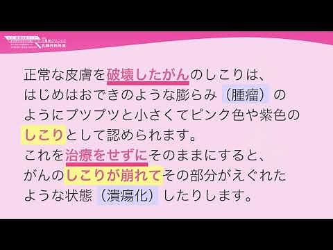 “花咲き乳がん”とは？皮膚科的なできものとの違い
