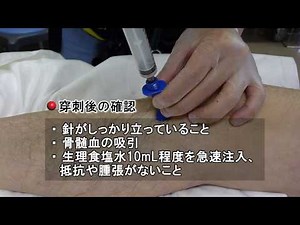 骨髄輸液（IOI）