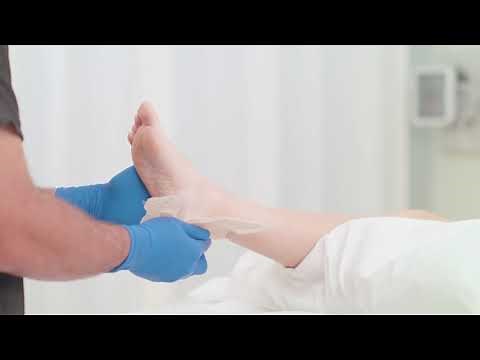 Mepilex Border Heel application (short version)