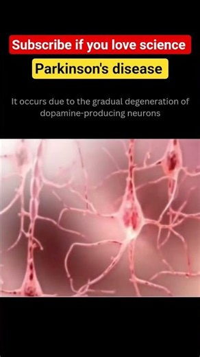 Let's know about- Parkinson's disease