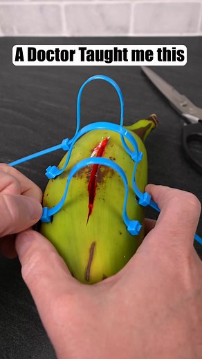 Easy Life Hack to Close a Cut Quickly