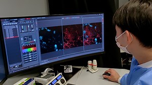 Intravital Subcellular Microscopy of the Mammary Gland