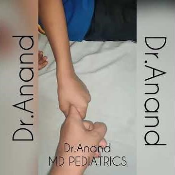 Clinical teaching - identify the sign ? #pediatricsbydranand