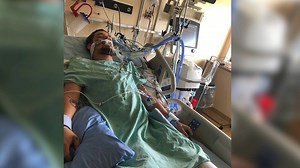 25-year old Hamilton man in hospital after sustaining multiple injuries in a motorcycle accident - CHCH