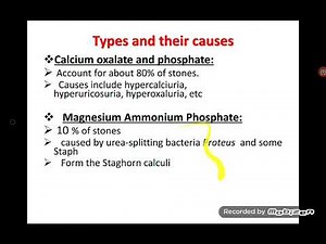Obstructive Uropathy