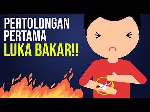 First Aid for Burns!!