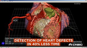 7.9K views · 229 reactions | With cutting edge technologies, doctors can view MRI imaging scans as a 3-D hologram of patients' insides! | Newcastle Clinic | Facebook