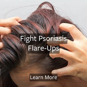 30K views · 69 reactions | Plaque psoriasis is an autoimmune disease that causes skin cells to multiple faster than normal. Learn what can triggers flare up and how to treat them. | HealthVersed | Facebook
