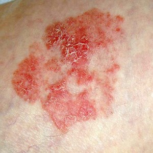 Die Zweite Haut [1978] DVDRip