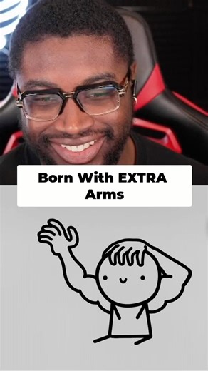 People Are Born With EXTRA Limbs?! 😳🧠