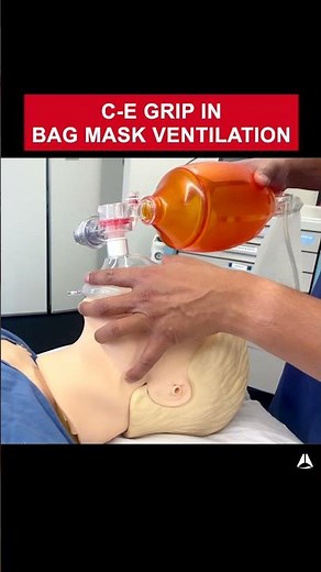 C-E Grip in Bag Mask Ventilation | #anesthesia #bagmaskventilation #airway