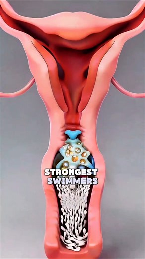 AUMA CLARIFY NOW on Instagram: "The Birth Control Sponge: A Simple 3-Step Defense"