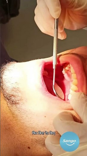 Dental education By Sango #dental #dentist #doctor #india #oralcare #oral #teeth