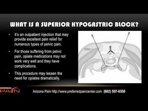 Superior Hypogastric Blocks for Pelvic Pain Explained (602) 507-6550