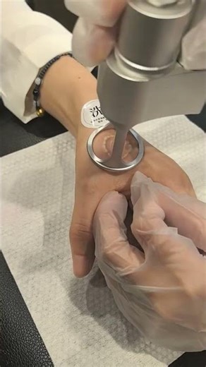The Tattoo removal machine 😍