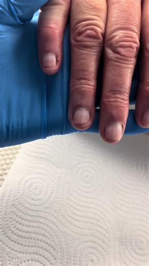 What a transformation! 🔥🔥🔥#nailtechlife #nailtok #gelnails #nailtech #nailspo #glampro #rubberbase #beforeandafter #gelxnails #fullcovertips #opi