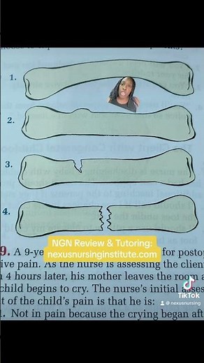 Fractures 👩🏾‍⚕️📚🩺