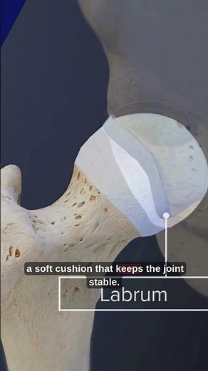 Why Your Hip Hurts What a Labrum Tear Really Looks Like Must Watch!” #humananatomy #healthhub