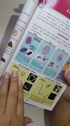 Vermes adultos do Ascaris lumbricoide - Parasitologia