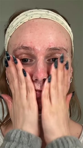 That Kaity Smith on Instagram: "Go to night routine recently Patch from @thatacnegirly Cleansing balm @dr.altheaglobal @untoxicatedskincare @sharkbeauty led mask @mixsoon_usa bean essence Eye patches @beautyofjoseon_official #acne #acneskincare #kbeauty"