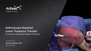 Arthroscope-Assisted Lower Trapezius Transfer for Massive Irreparable Rotator Cuff Tears
