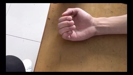 Brunnstrom六阶段分期视频演示