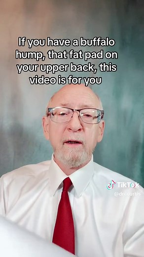 Addressing the Causes of Buffalo Hump: Cortisol Dysregulation & Health Risks