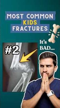 Top 3 Broken Bones in Kids! (RANKED) | Most Common Paediatric Fractures