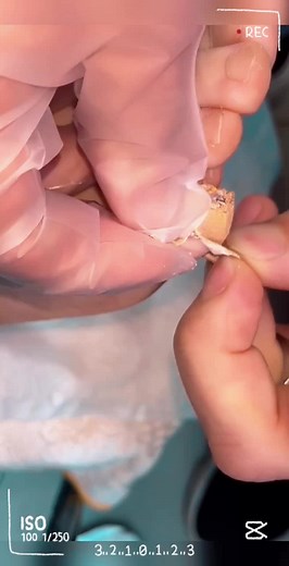 Professional Pedicure Techniques for Healthy Feet