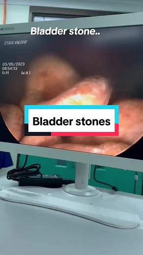 DrSyah_Urologist on TikTok