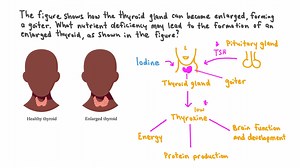 Identifying the Cause of an Enlarged Thyroid Gland.