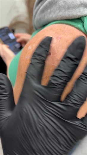 Iryna Brik Fine Line Tattoo Sarasota Florida on Instagram: "Freckles tattoos Fine Line Tattoo Sarasota Florida Fine line tattoo / Sarasota tattoo / Delicate tattoo / Clean lines / Floral tattoo / Flower tattoo / Female tattoo artist / Aesthetic tattoos / Micro realistic tattoo / Script tattoo / Cross tattoo / Quote tattoo / Lettering tattoo/ Fine line art / Minimalist tattoo / Elegant tattoo / Small tattoo / Tiny tattoo / Tattoo design / Abstract tattoos / Florida tattoo artist / Realism Tattoo