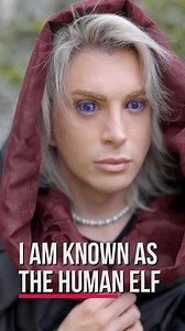 I've spent $85,000 on plastic surgery to turn into the human elf 😳 | Hooked On The Look