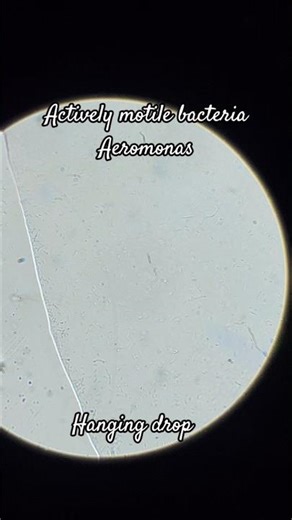 Motility by Hanging Drop method. Actively motile Aeromonas