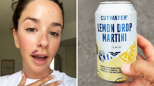 ‘Are cutwaters the new Four Loko’: Woman drinks 1 Cutwater Lemon Drop Martini. Then she notices something above her lip