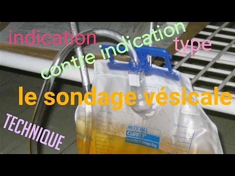 sondage vésicale