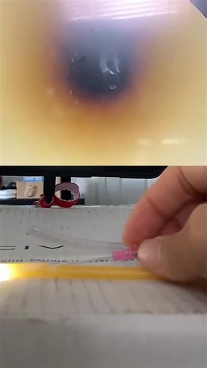 TheVascularGuy on Instagram: "Sim - Needle Rotation.mp4"