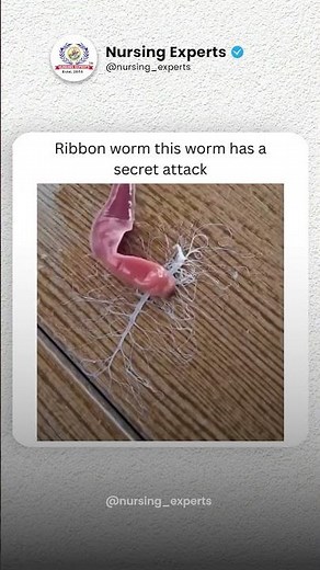 🪱 Meet the Ribbon Worm – The Slimy Creature With a REAL Superpower! 😱🌊 | Nursing