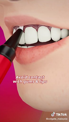 Dreaming of ✨sparkling white teeth✨? Here's how to use the Colgate Optic White® Overnight Teeth Whitening Pen correctly for best results. #FYP #Colgate #ColgateSmile #SpreadSmiles #ColgateMY #SmileOutLoud