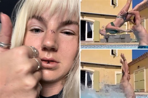 Woman left with broken nose, missing teeth after attempting ‘Dirty Dancing’ lift with boyfriend